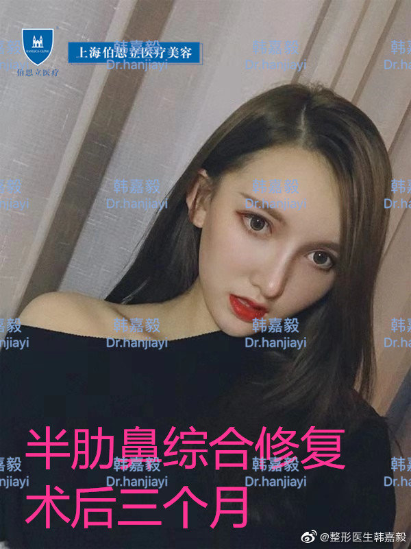 韓嘉毅鼻修復案例