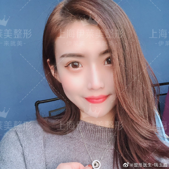 錢玉鑫隆鼻案例