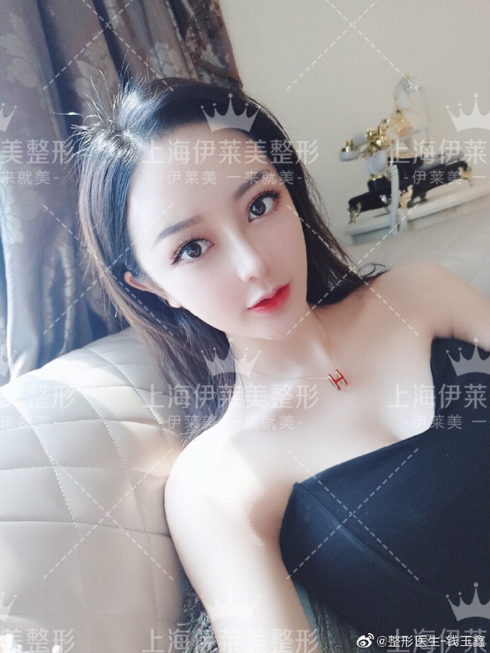 錢玉鑫隆鼻案例