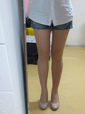 上海大腿抽脂哪個醫生比較厲害？術后效果好？
