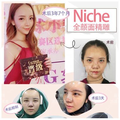 喬愛軍面部精雕