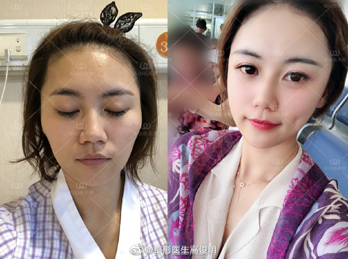 高俊明改臉型案例