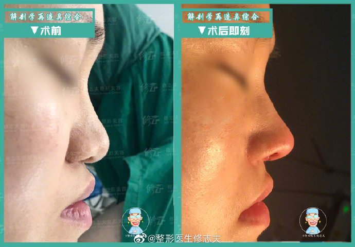 廈門修志夫技術好不好?想找他做鼻子。