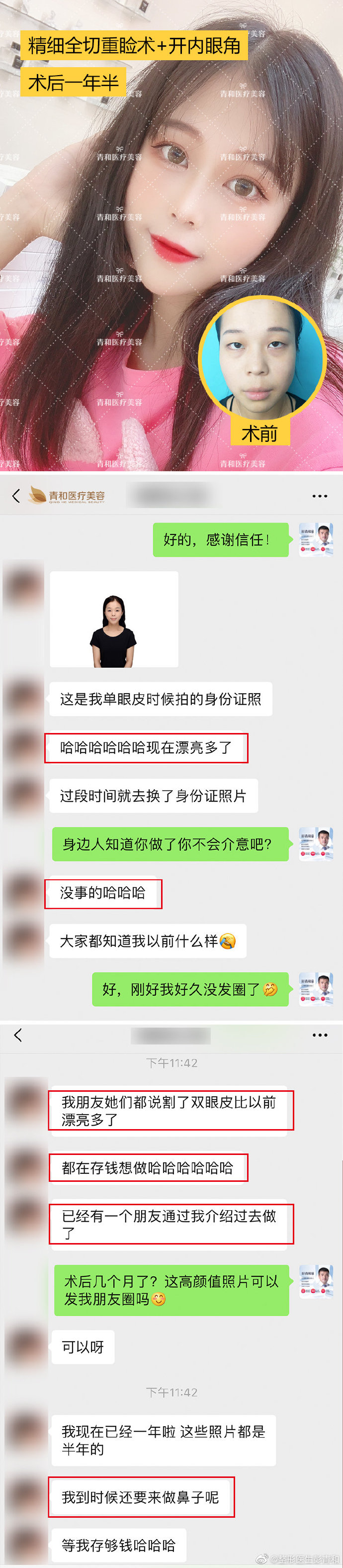 彭青和雙眼皮案例