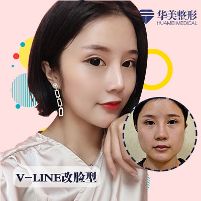 付國友磨骨案例