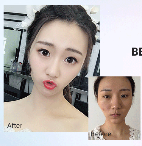 劉先超頜面案例