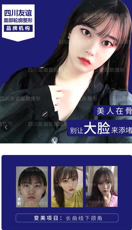 李繼華改臉型案例