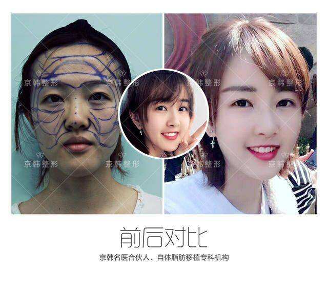 喬愛軍生長因子案例