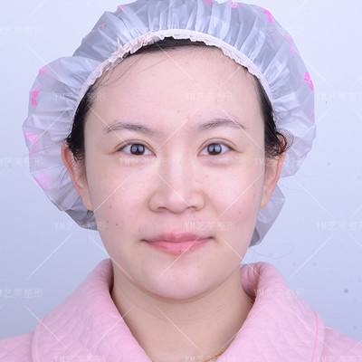 脂肪失敗修復怎么修復？北京哪位醫生擅長做脂肪修復？