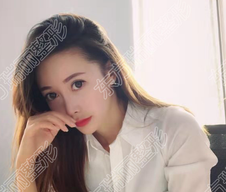 鼻尖修復