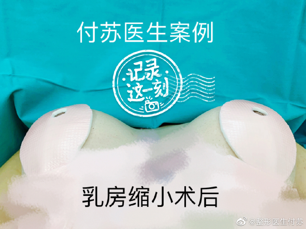 付蘇醫生案例