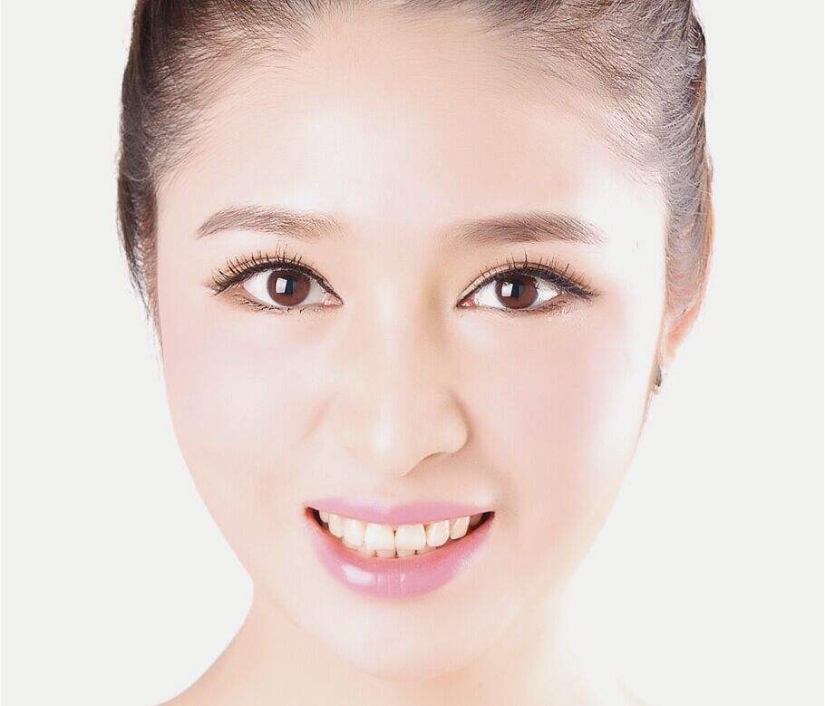 上海九院割雙眼皮最好的專家是誰？