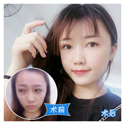 廣州脂肪填充最好的醫生是哪位？