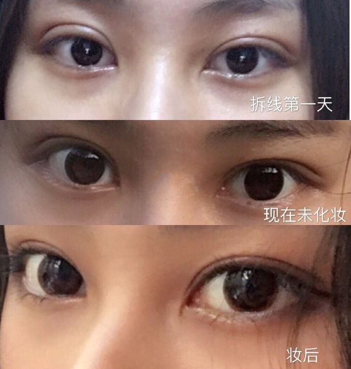 上海九院眼睛修復(fù)專(zhuān)家排名