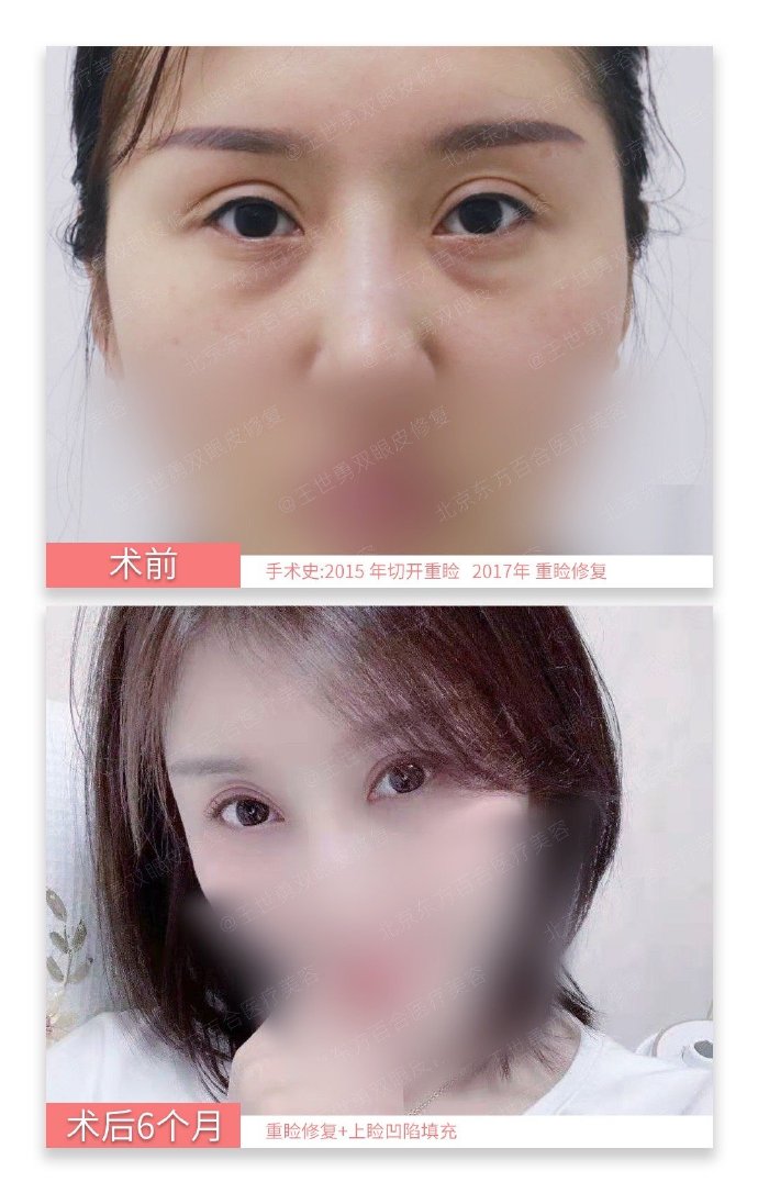眼部修復專家國內知名都有哪些？