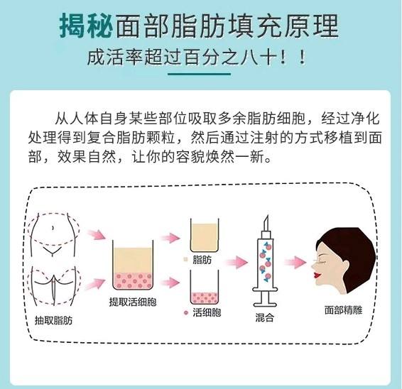 北京做面部充填最好的醫(yī)生