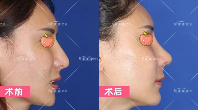 深圳鼻修復(fù)專家有哪些？