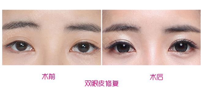 中國眼修復專家劉風卓和王振軍哪個更厲害？