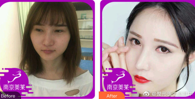趙其中鼻子案例