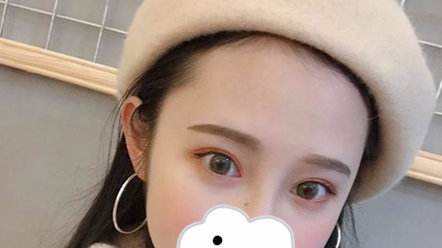 上海九院修復雙眼皮最好的專家