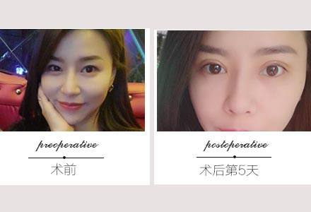 國內最擅長做眼部修復的醫生排名