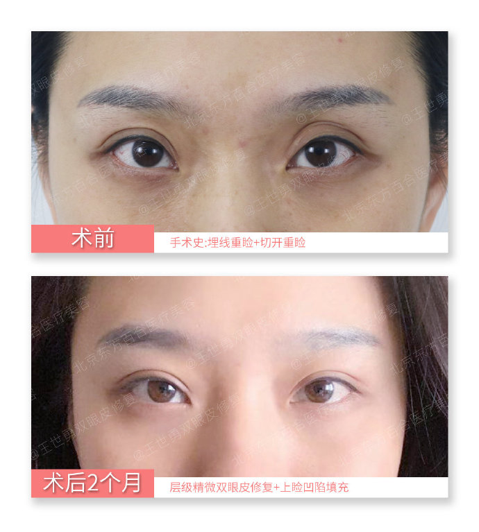 中國十佳眼部整形修復的專家