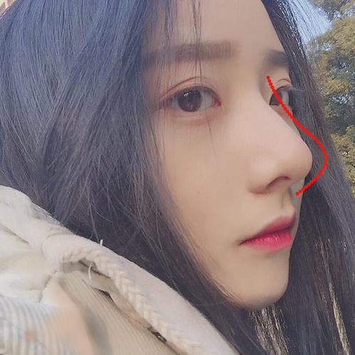 成都鼻綜合出名的醫生是哪個？