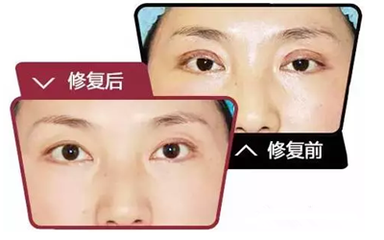 石家莊眼修復專家都有哪些?