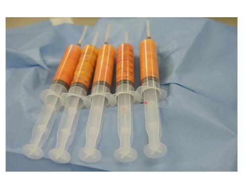 北京八大處脂肪修復專家