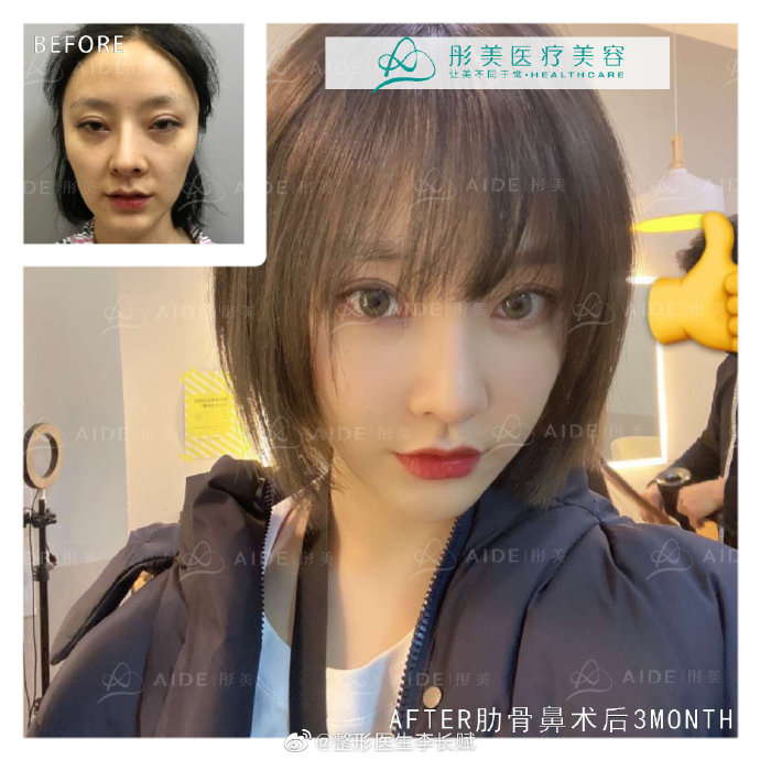 李長賦鼻綜合案例
