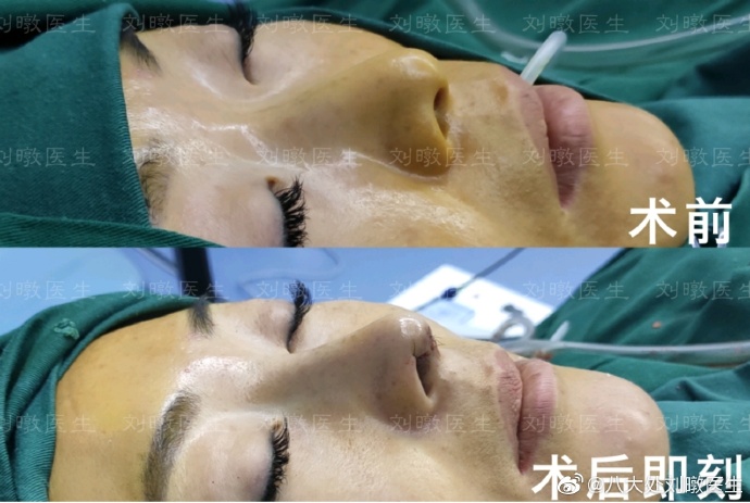 劉暾鼻綜合案例