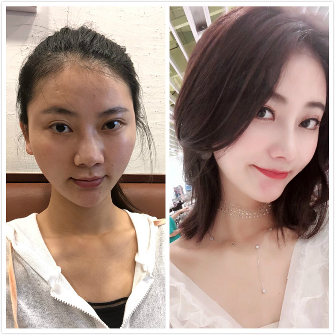 杭州哪個醫生做鼻修復好