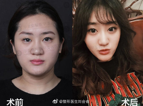 2020成都脂肪填充權威醫生有哪些？
