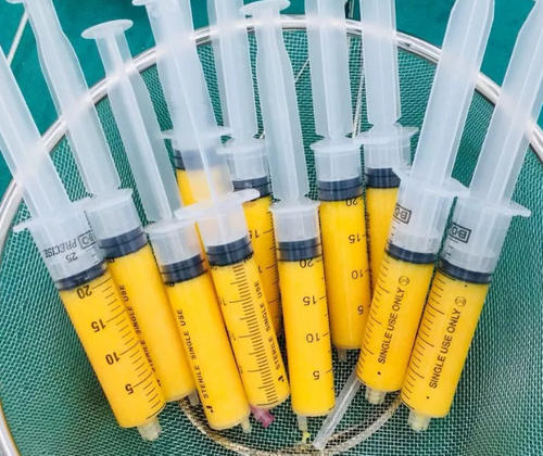 王明利李朕王沛森喬愛(ài)軍哪個(gè)做自體脂肪豐胸好？