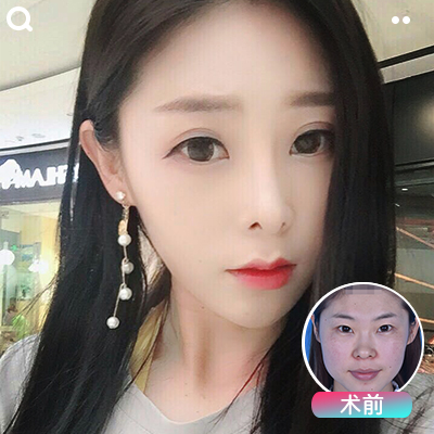 魏恒鼻綜合案例