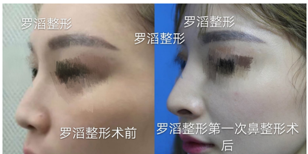 2020年長沙鼻綜合的醫(yī)生排名