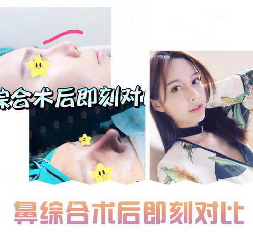 南京鼻綜合手術口碑好的醫生
