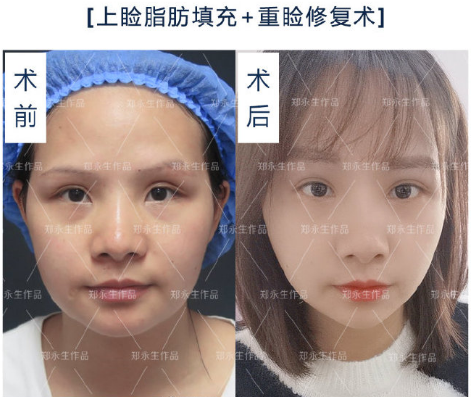 修復眼部的十大專家哪個技術最好?