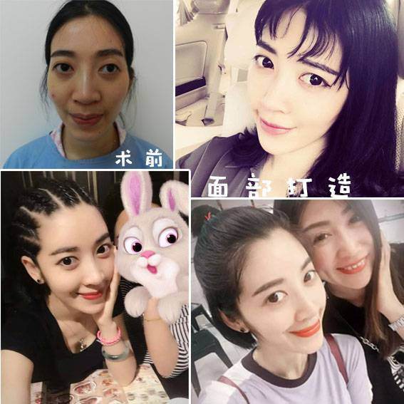 武漢哪個醫(yī)生做脂肪填充好？