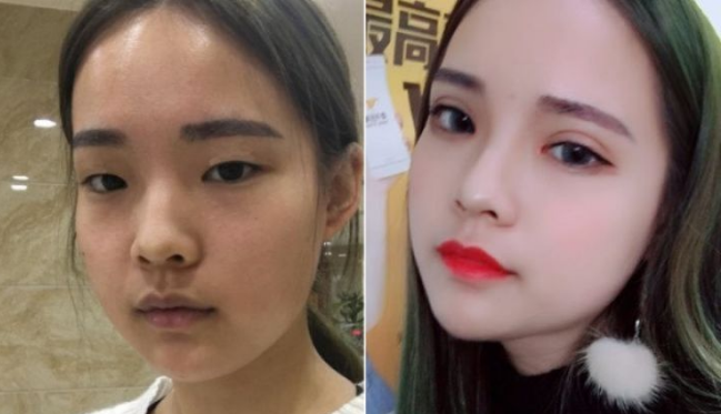 鄭州眼綜合哪里做得好？鄭州雙眼皮醫生推薦