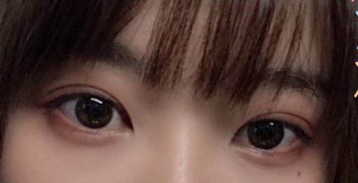 上海雙眼皮哪里做得比較好？上海雙眼皮醫(yī)生排名