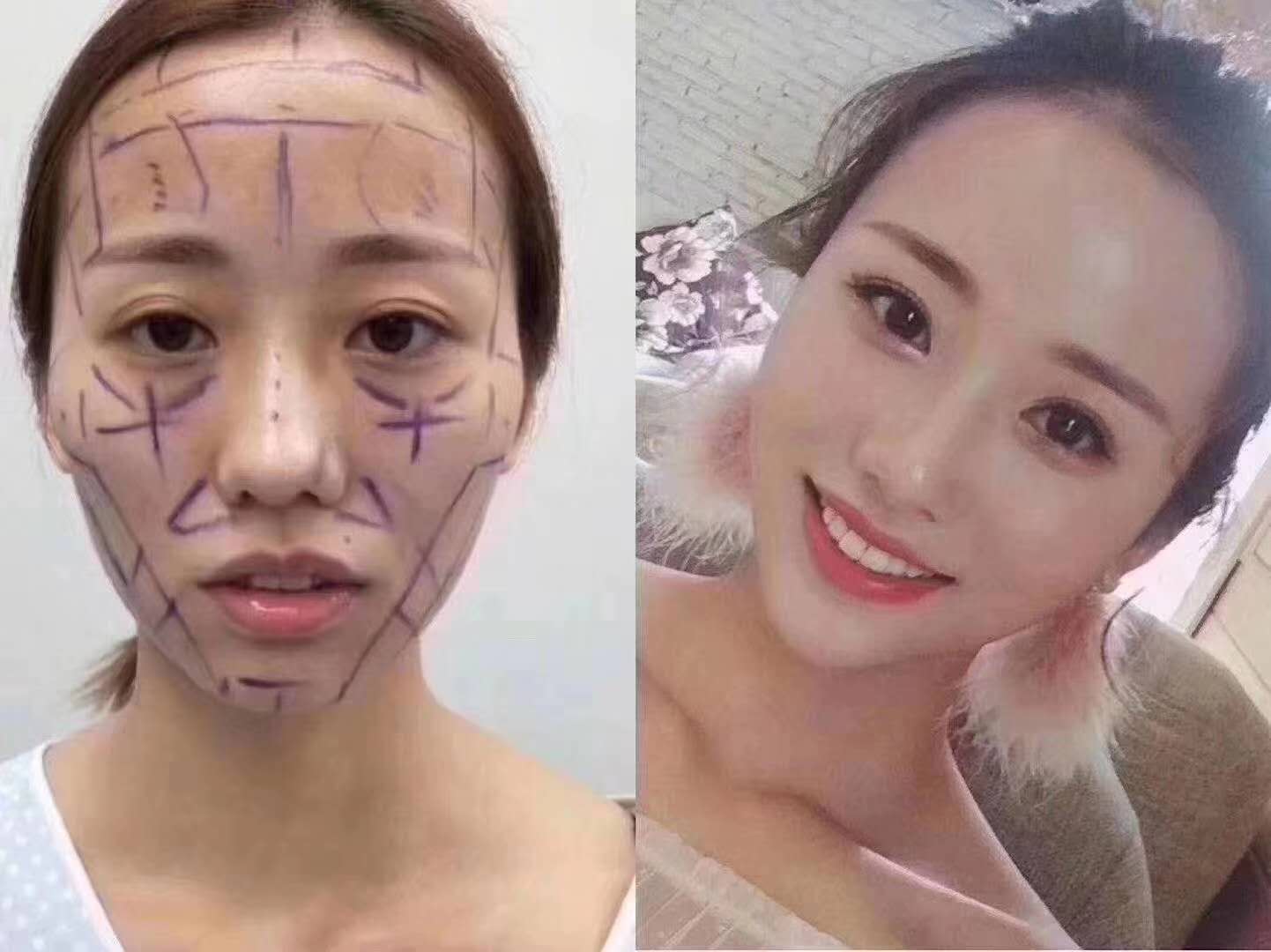 上海九院面部脂肪填充哪個醫(yī)生好？