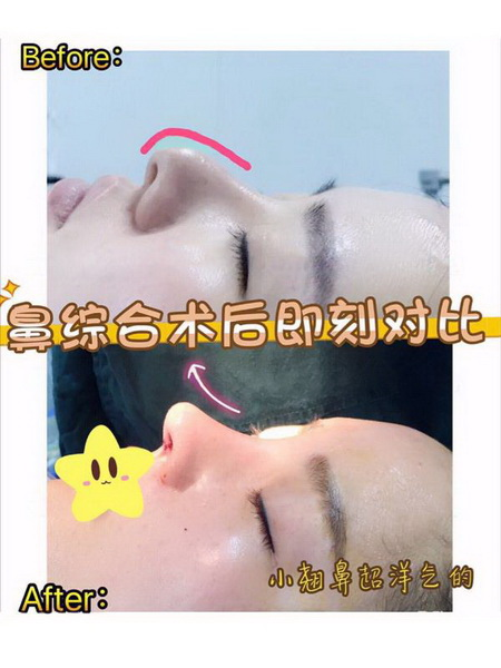  北京八大處鼻子誰做得好？北京八大處鼻綜合醫生