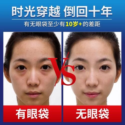上海九院祛眼袋哪位專家技術好？