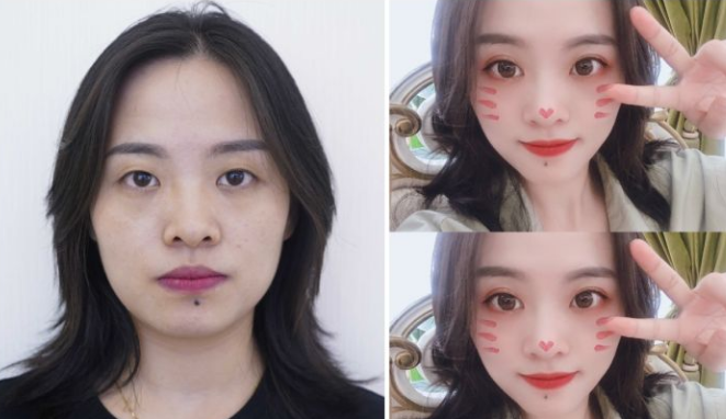 長沙做雙眼皮最出名的醫生排名