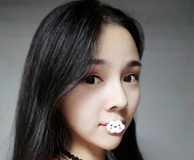 成都黃開亮和盧元剛哪個做鼻子好？