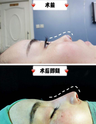 眼鼻修復