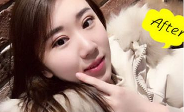 合肥王大勇和甘泉涌哪個技術好