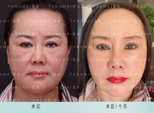 潘彥龍小切口提升案例