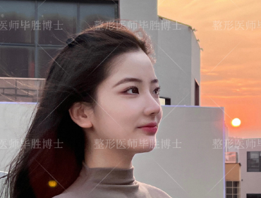 重慶畢勝醫生鼻修復怎么樣